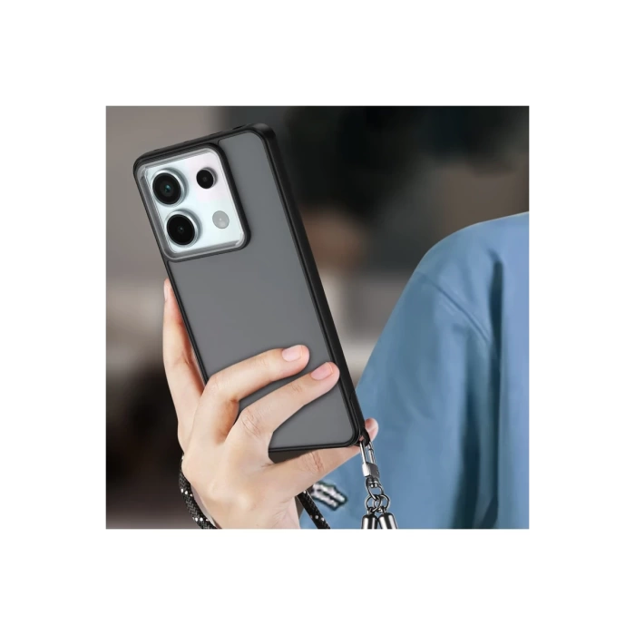Newface Xiaomi Redmi Note 13 Pro 5G Kılıf Elegant Kapak - Pudra