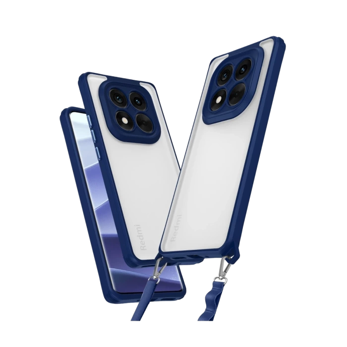 Newface Xiaomi Redmi Note 14 Pro Plus Kılıf Penta Silikon Kılıf