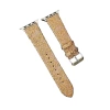 Newface Apple Watch 38mm Creeper Desenli Kordon - Gold