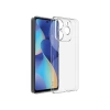 Newface General Mobile Era 50 Kılıf Lüx Şeffaf Silikon