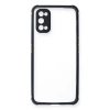 Newface Realme 7 Pro Kılıf Miami Şeffaf Silikon