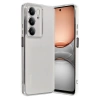 Newface Realme C75 4G Kılıf Razer Lensli Silikon