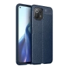 Newface Xiaomi Mİ 11 Lite Kılıf Auto Focus Kapak