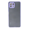 Newface Xiaomi Mİ 11 Lite Kılıf Montreal Silikon Kapak