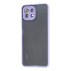Newface Xiaomi Mİ 11 Lite Kılıf Montreal Silikon Kapak
