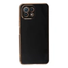 Newface Xiaomi Mİ 11 Lite Kılıf Volet Silikon