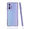 Newface Xiaomi Mi 11T Pro Kılıf Platin Silikon