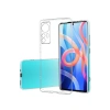 Newface Xiaomi Mi 12 Kılıf Lüx Şeffaf Silikon