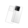 Newface Xiaomi Mi 13T Pro Kılıf Lüx Şeffaf Silikon