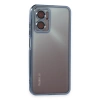 Newface Xiaomi Redmi 10 5G Kılıf Razer Lensli Silikon
