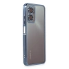 Newface Xiaomi Redmi 10 5G Kılıf Razer Lensli Silikon