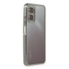Newface Xiaomi Redmi 10 5G Kılıf Razer Lensli Silikon