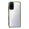 Newface Xiaomi Redmi Note 11 Kılıf Razer Lensli Silikon