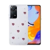Newface Xiaomi Redmi Note 11 Pro Fiyonk Desenli Kapak