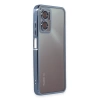 Newface Xiaomi Redmi Note 11E Kılıf Razer Lensli Silikon