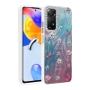 Newface Xiaomi Redmi Note 12 Pro 4G Kılıf Blade Aynalı Desenli Kapak