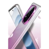 Newface Xiaomi Redmi Note 14 Pro 5G Glossy Kapak