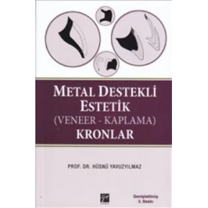 Metal Destekli Estetik (Veneer-Kaplama)Kronlar