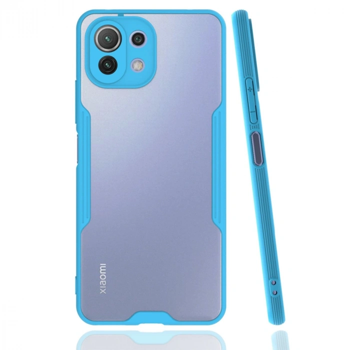 Newface Xiaomi Mi 11 Lite Kılıf Platin Silikon - Mavi