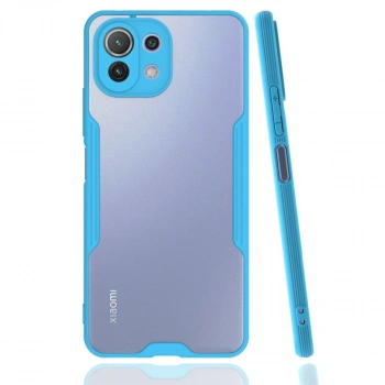 Newface Xiaomi Mi 11 Lite Kılıf Platin Silikon - Mavi