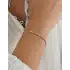 Baget Kesim Suyolu Bileklik