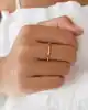 Kemik Yüzük