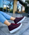 Shoecide Shch258 Cbt Roma Kadın Bot Bordo