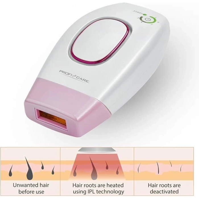 PROFICARE IPL Lazer Epilasyon Cihazı