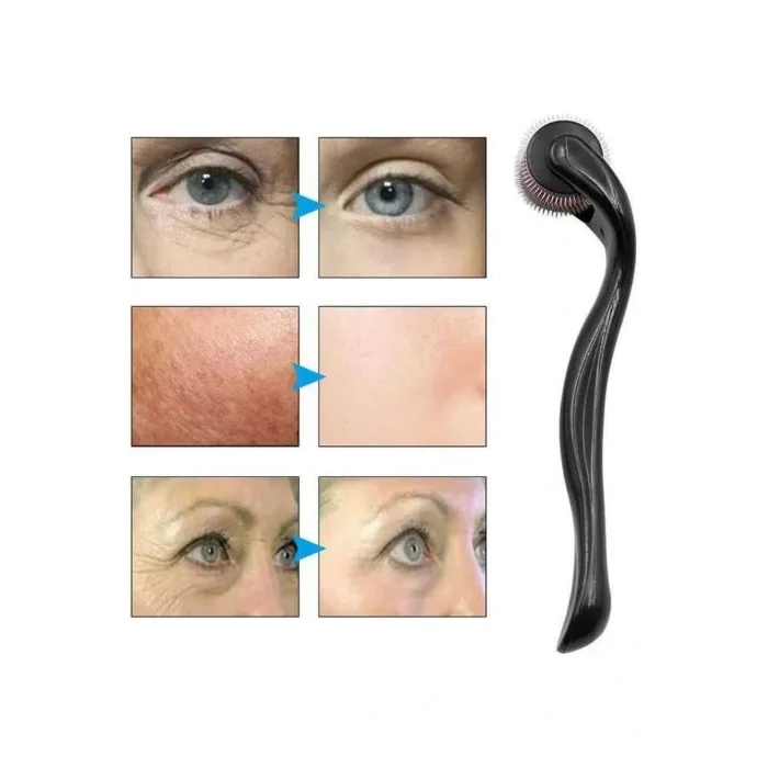 Dermaroller Titanyum 540 Iğneli 1 Mm Saç Kaş Sakal Serum Kullanıma Uygun