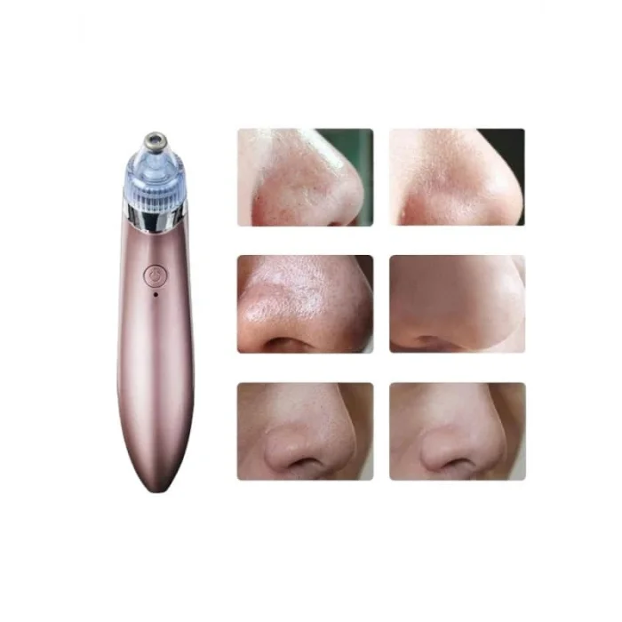 SİYAH NOKTA CİHAZI