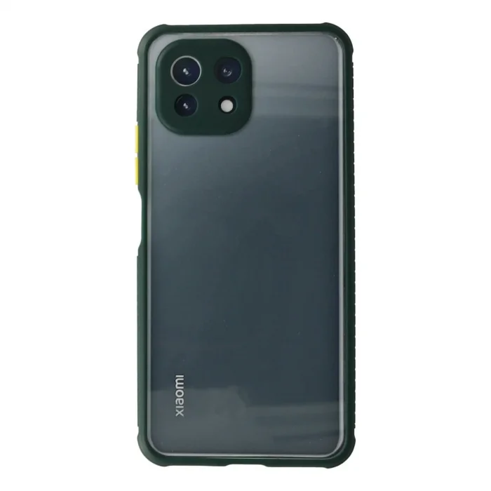 Xiaomi Mi 11 Lite Kılıf Miami Şeffaf Silikon - Koyu Yeşil
