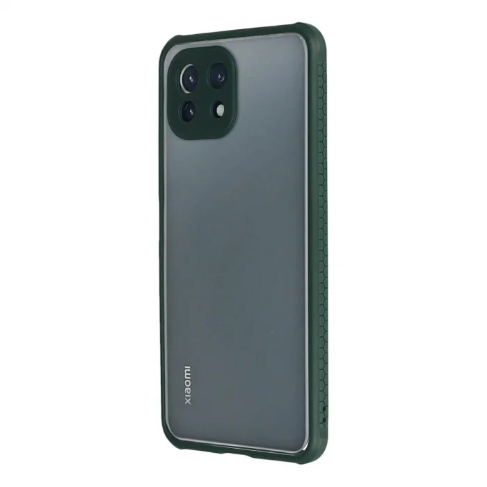 Xiaomi Mi 11 Lite Kılıf Miami Şeffaf Silikon - Koyu Yeşil