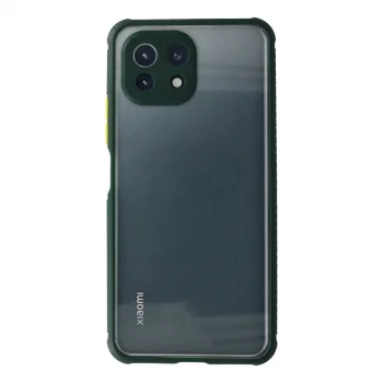 Xiaomi Mi 11 Lite Kılıf Miami Şeffaf Silikon - Koyu Yeşil