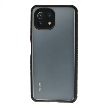 Xiaomi Mi 11 Lite Kılıf Miami Şeffaf Silikon - Siyah