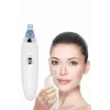 4 Başlıklı Pilli Vakumlu Siyah Nokta Temizleyici Akne Ve Sivilce Önleyici