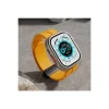 Apple Watch 38mm Kr412 Elegance Stylısh Kordon (saat Değildir) - Koyu Yeşil
