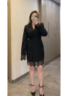 Dantelli Ceket Elbise