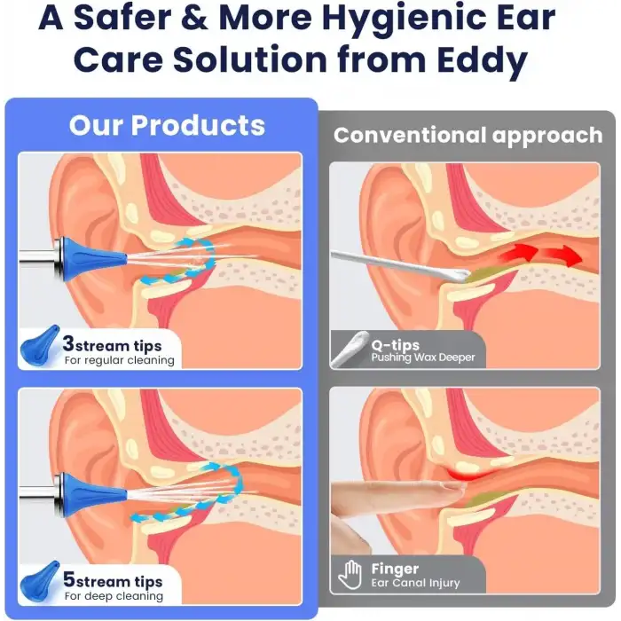 Auracle Kulak Kiri Temizleme - 4 Su Basınç Modu Kulak Temizleyici - Mavi