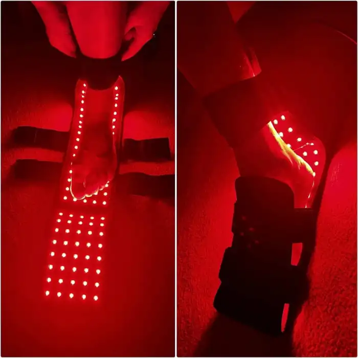 CAMECO Kızılötesi Işık Terapi Kemeri - 640nm-660nm-880nm