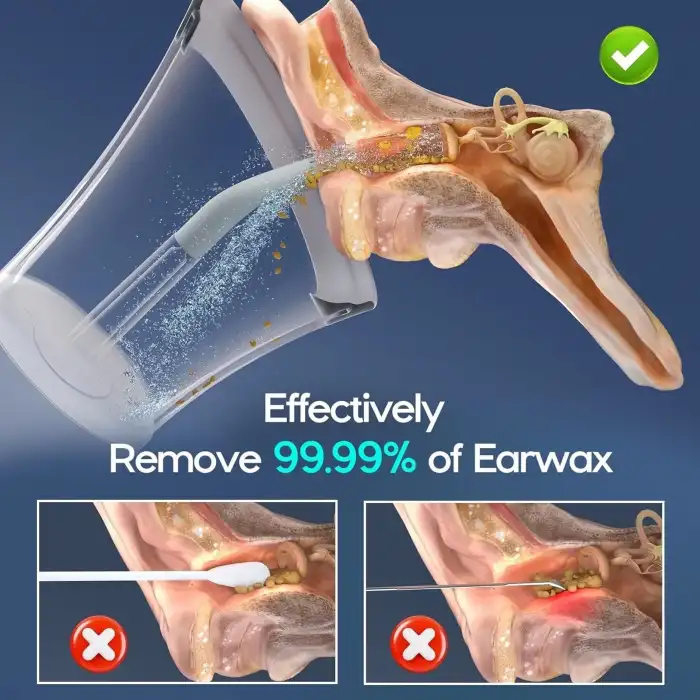 Morfone Elektrikli Etkili ve Güvenli Kulak Temizleme Kiti - Gri