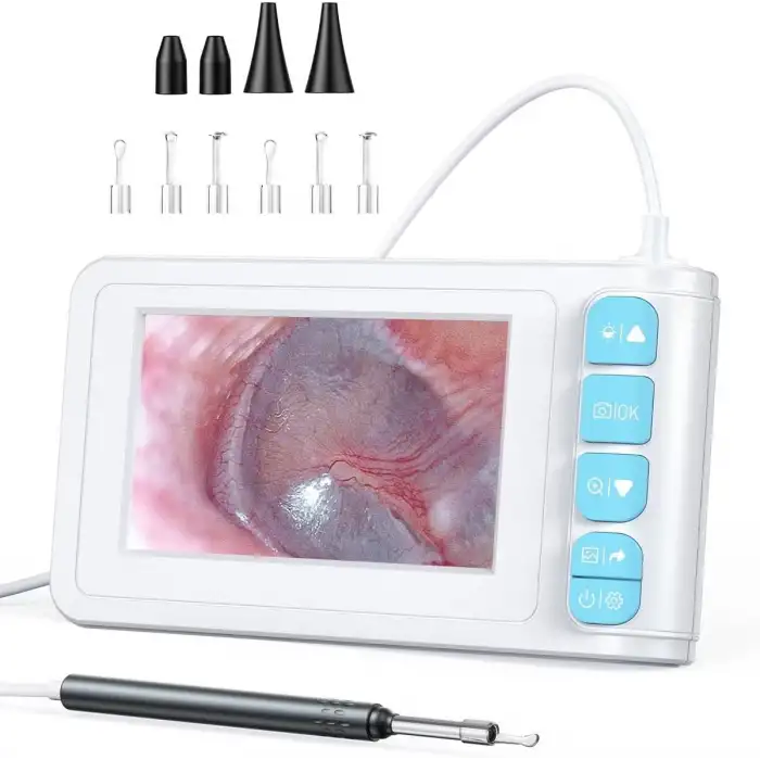 SKYEAR Işıklı Kulak Kiri Temizleme Aracı Kamerası - 4.3 Inc Ekran