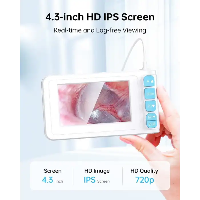 SKYEAR Işıklı Kulak Kiri Temizleme Aracı Kamerası - 4.3 Inc Ekran