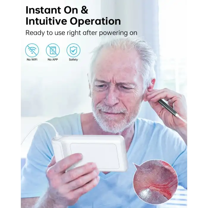 SKYEAR Işıklı Kulak Kiri Temizleme Aracı Kamerası - 4.3 Inc Ekran