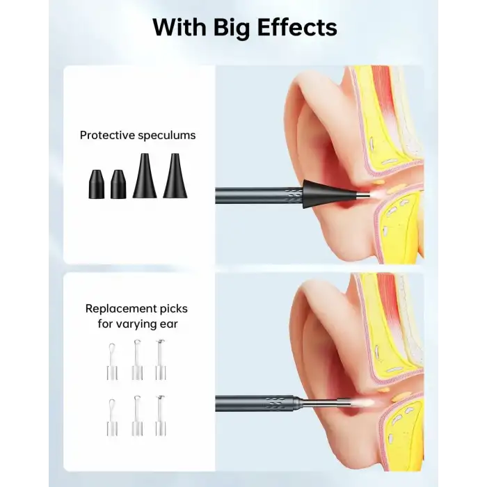 SKYEAR Işıklı Kulak Kiri Temizleme Aracı Kamerası - 4.3 Inc Ekran