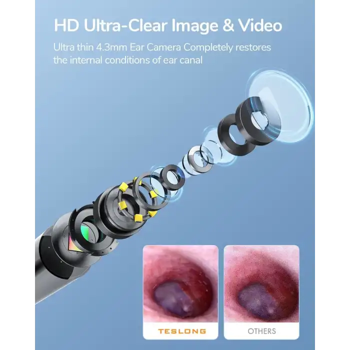Teslong Dijital Otoskop - Kulak Kiri Gidericili 720p HD