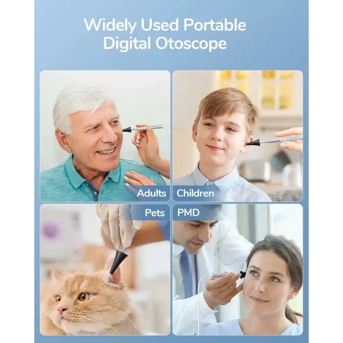 Teslong Dijital Otoskop - Kulak Kiri Gidericili 720p HD