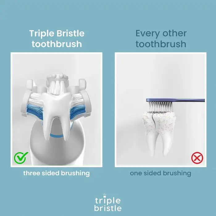 Triple Bristle GO - Üç Taraflı Sonic Diş Fırçası - Yumuşak Naylon Kıllar - 1 Adet