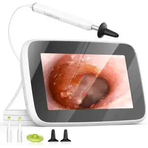 ScopeAround Dijital Otoskop Işıklı, Kulak Temizleme Kamerası