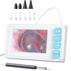 SKYEAR Işıklı Kulak Kiri Temizleme Aracı Kamerası - 4.3 Inc Ekran