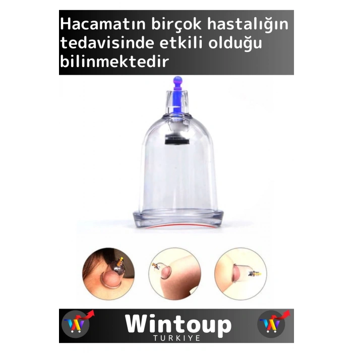 Özel Üretim Yüksek Kaliteli Selülit Çatlak Giderici Vakumlu 6lı Hacamat Kupası Seti